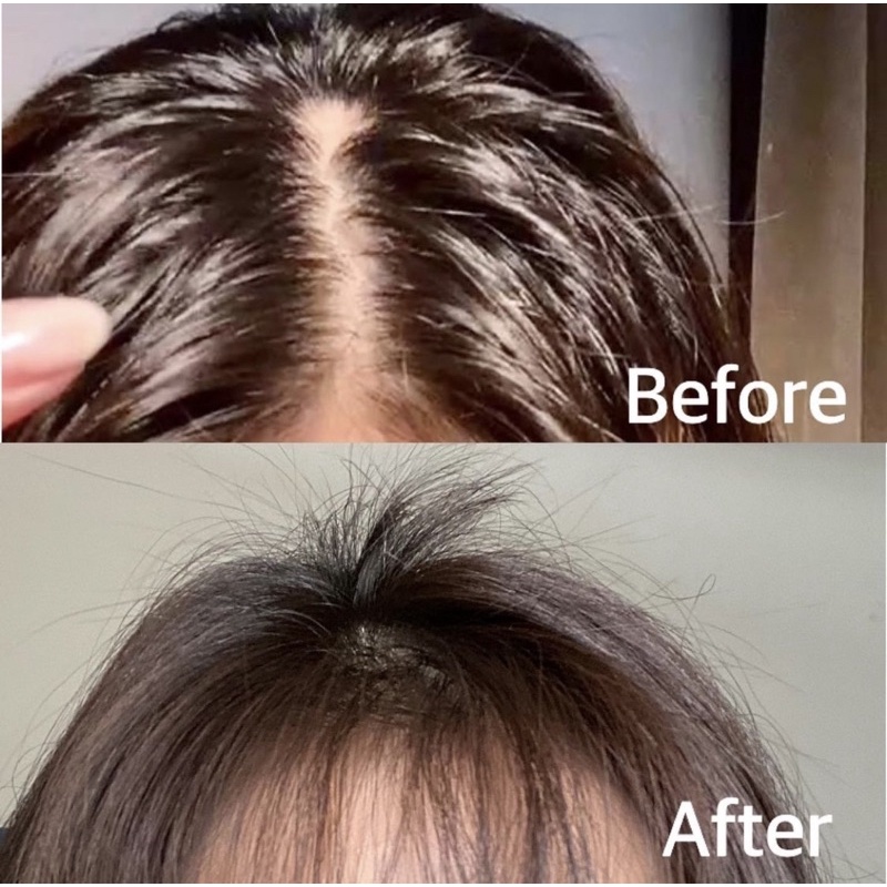 Scalp Therapy Natural Vegan Water-Based Hair Tonic - Everlaskin-1