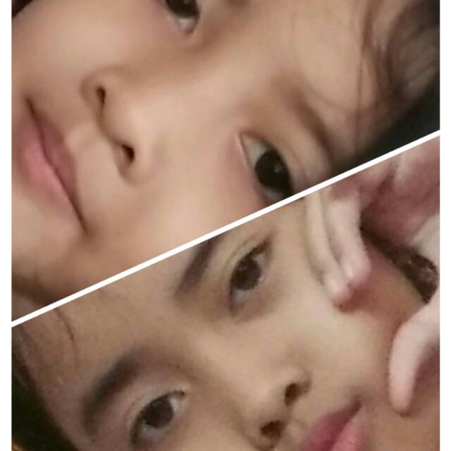 ophieacha