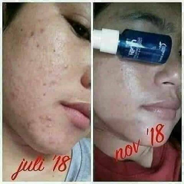 Serum gold MSI menghilangkan flek hitam
