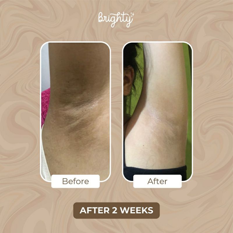 Brighty Gel Glowing Underarm Pemutih Ketiak dan Lipatan