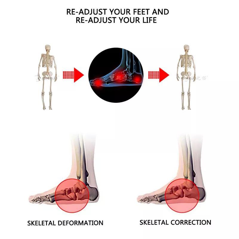 INSOLE FLAT FOOT SOL SEPATU KAKI DATAR SOL SEPATU PRIA ALAS SEPATU PRIA INSOLE ARCH SUPPORT