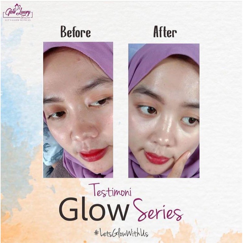 Paket GLOW LUXURY series glow BPOM