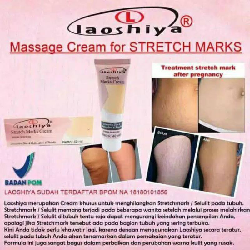 ‼️READY‼️LAOSHIYA CREAM Stretchmarks / PENGHILANG STRETCHMARKS