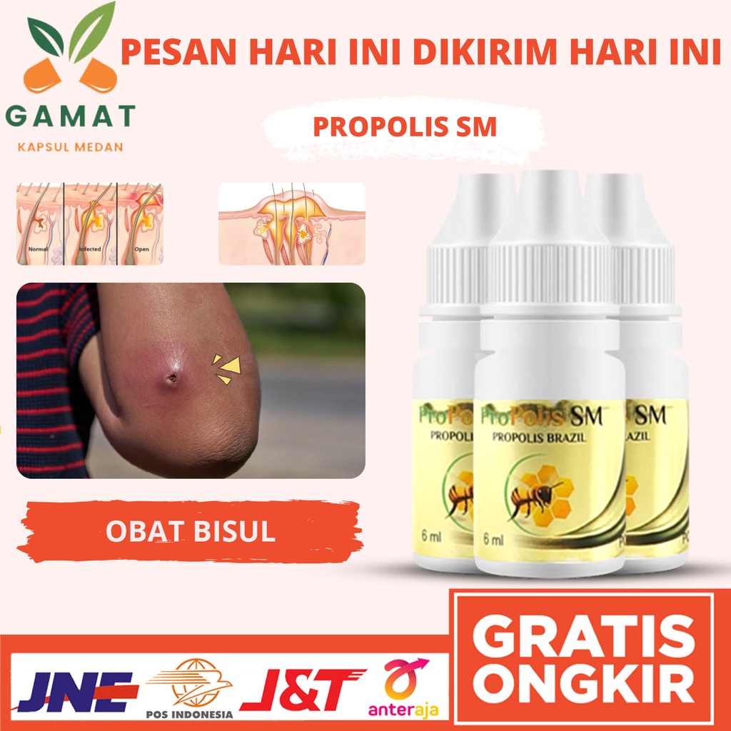 Obat Bisul - Obat Bisul Bernanah - Obat Bisul Menahun - obat Bisul Menahun - Obat Bisulan - Obat Bis