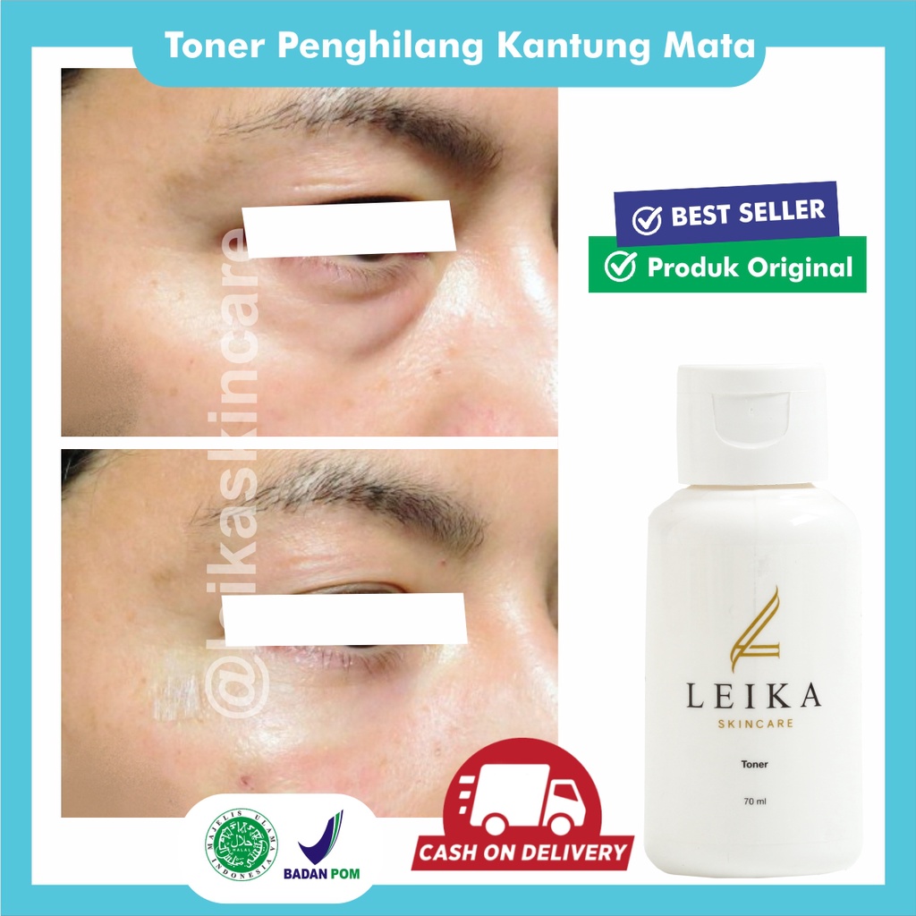 Penghilang Kantung Mata Permanen Toner Menghilangkan Kantung Mata AMPUH Perawatan Mata Kantung Mata 