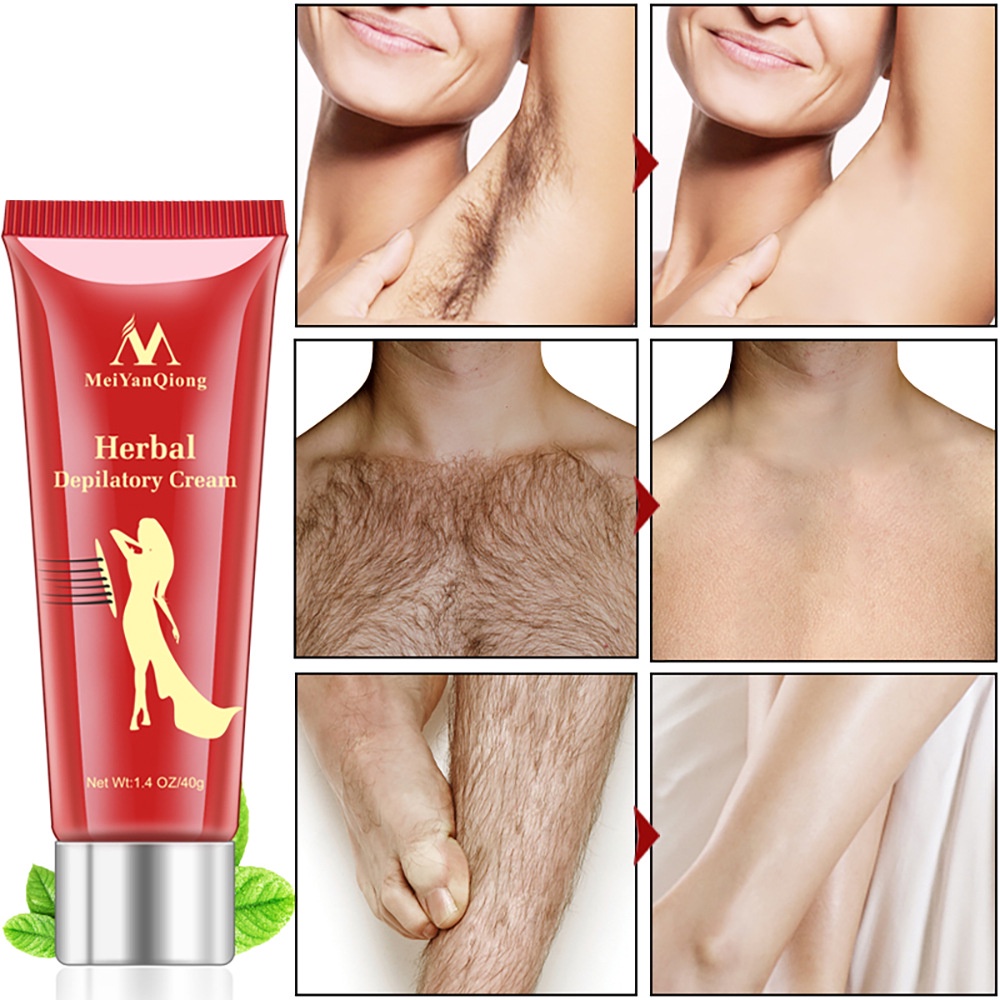 MeiYanQiong Hair Removal Cream  Normal Skin Perontok Bulu Permanen Kulit Normal Penghilang Bulu Tanpa Iritasi 40g