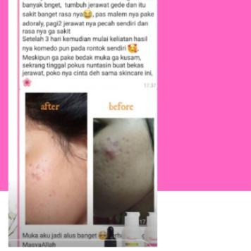 ❂ ADORALY SKINCARE official store ADORALY SKINCARE original ADORALY ☄