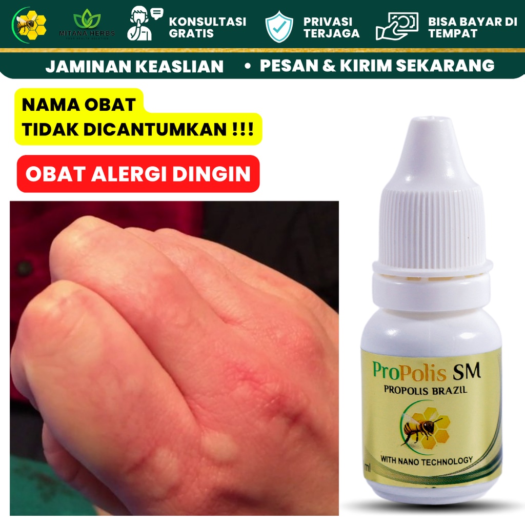 Mitana Herbal / Obat Alergi Dingin / Obat Alergi Gatal Kulit / Obat Gatal Alergi / Obat Biduran Aler