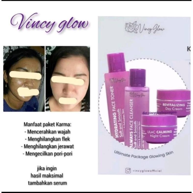 VINCY GLOW//VINCY GLOW PAKET KARMA