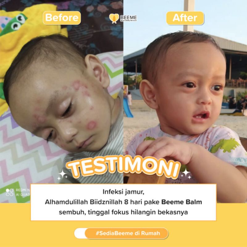 BEEME NOURISHING BALM BY MAMA SHEY | SKINCARE IBU DAN BAYI | SUNSCREEN SPF 50 | SOAP 3in1 |  BALM SERBAGUNA