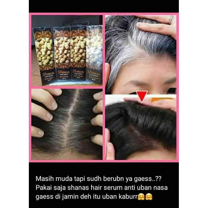 ANTI UBAN (SERUM ANTI UBAN NASA TERLARISS)