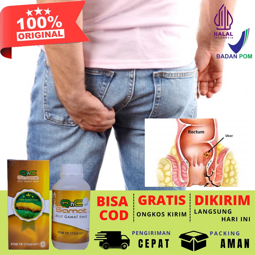 Obat Ambeien Wasir  Obat Fistula Ani - Glomerulonefritis Lubang Anus Berdarah Bernanah Keluar Nanah 