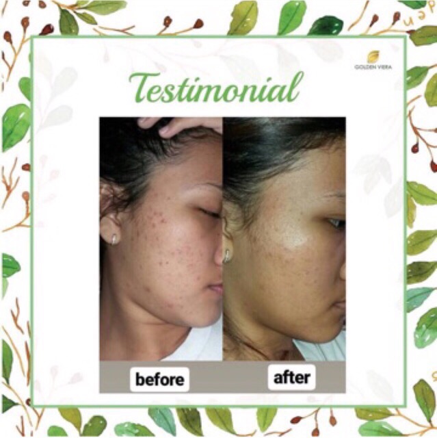 (READY) SABUN HERBAL GOLDEN VIERA KEMASAN TERBARU Paket 5pcs paket 10pcs FREE GIFT