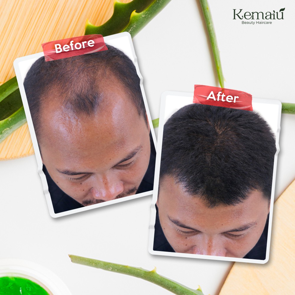 KEMAIU Hair Treatment HAIR TONIC Anti Rontok dan Penumbuh Rambut