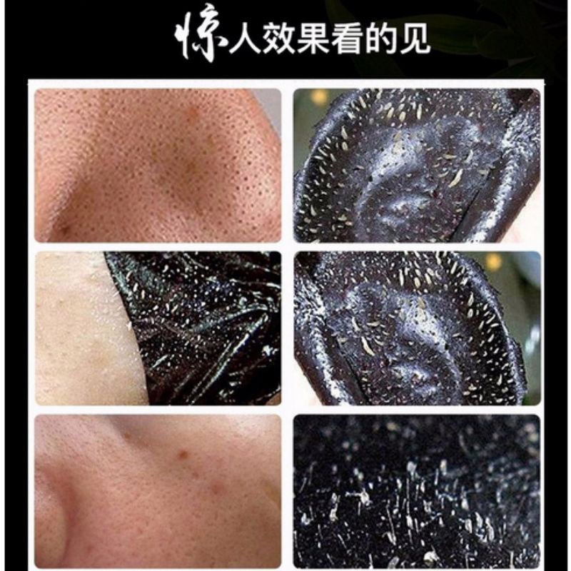 MASKER KOMEDO ACTIVATED CARBON BLACK MASK/MASKER KOMEDO