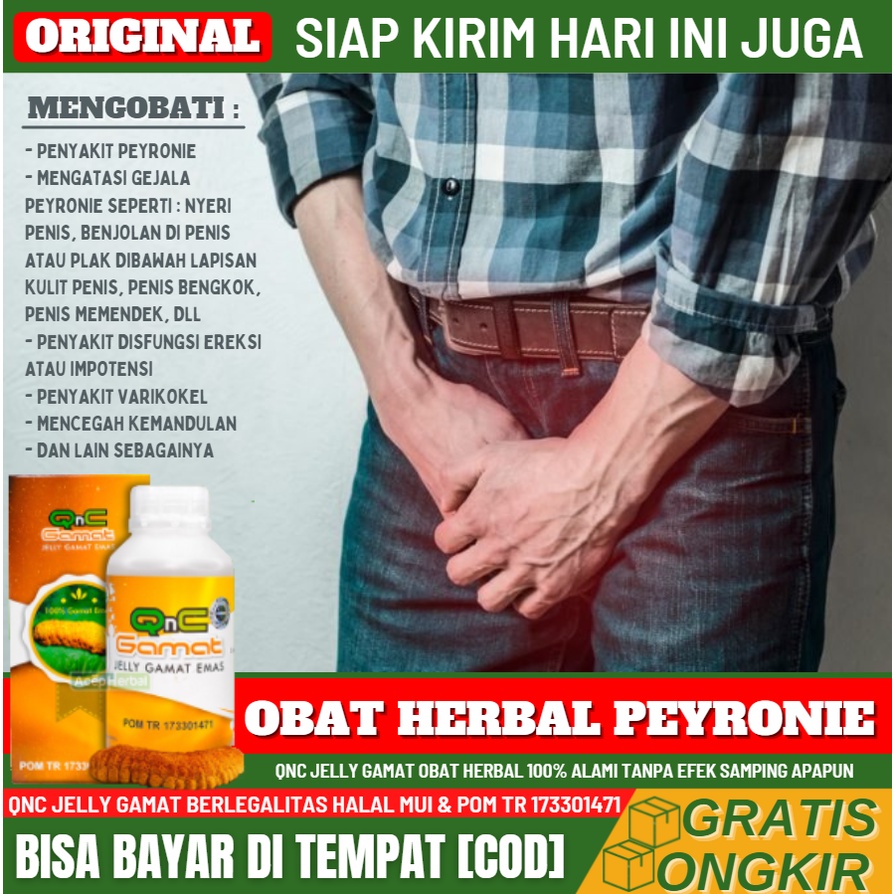 Obat Herbal Penyakit Peyronie 100% Alami, Herbal Atasi Penis Berubah Bentuk, Penis Bengkok ke Atas /