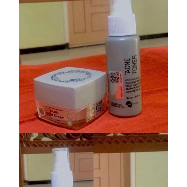 PRELOVED MS GLOW ACNE