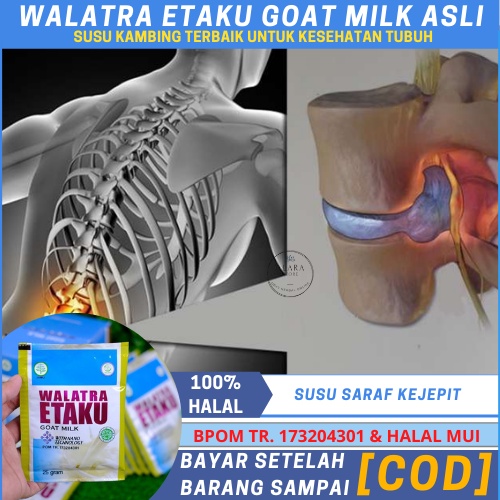 Susu Saraf Kejepit, Terjepit, Sarap Kejepit, Oabt Saraf Kejepit Di Pinggang, Leher, Sakit Pinggang B