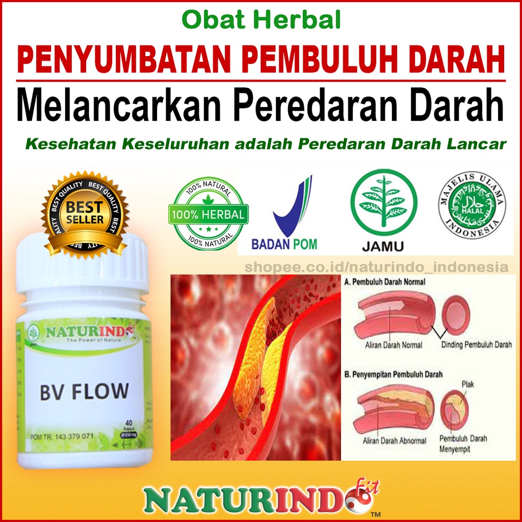 Jual Bv Flow Obat Herbal Penyumbatan Pembuluh Darah Melancarkan Peredaran Darah Gejala Kesemutan 5633