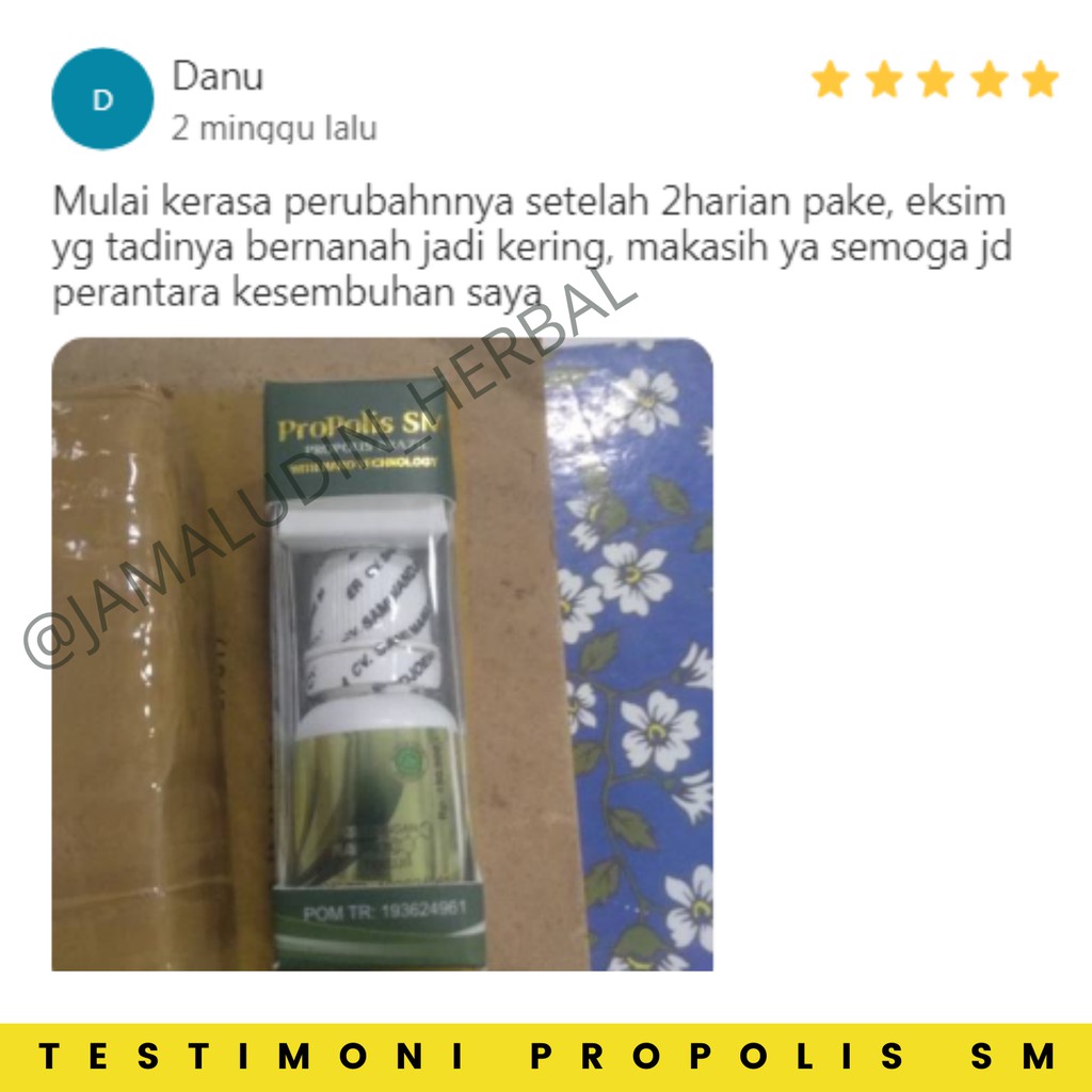 PROPOLIS SM - Obat Eksim Gatel Gatal Kulit Jamur Herbal - Obat Kulit Herbal - Obat Gatal - Obat Luka Diabetes - Obat Penyakit Kulit - Obat Exim - Obat Gatal Kulit - Obat Oles Bisul Jerawat Darah Kotor - Obat Salep Gatal Gatel Kulit Jamur Bakteri-3