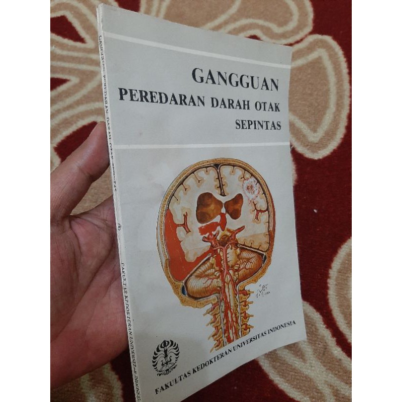 Gangguan Peredaran Darah Otak Sepintas
