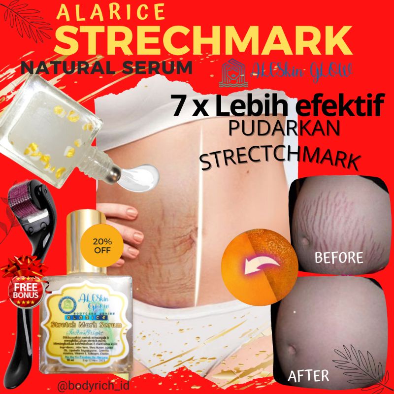 SALE PROMO !! ALARICE STRECHMARK CREAM PENGHILANG STRETCH MARK PALING AMPUH PERMANEN UNTUK IBU HAMIL