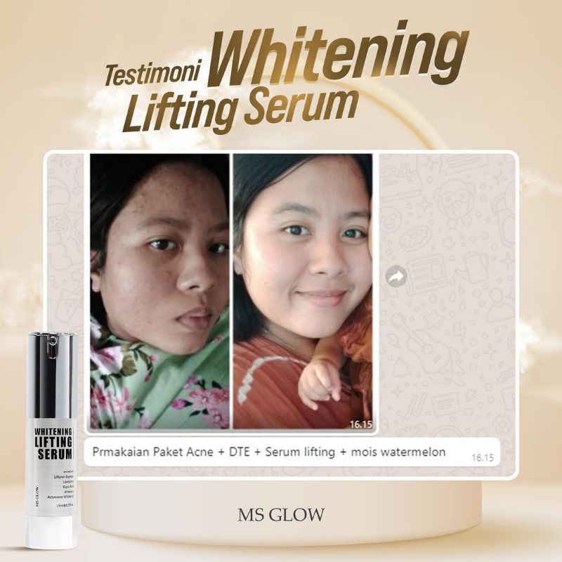 Lifting Whitening Serum 15 ml MS GLOW