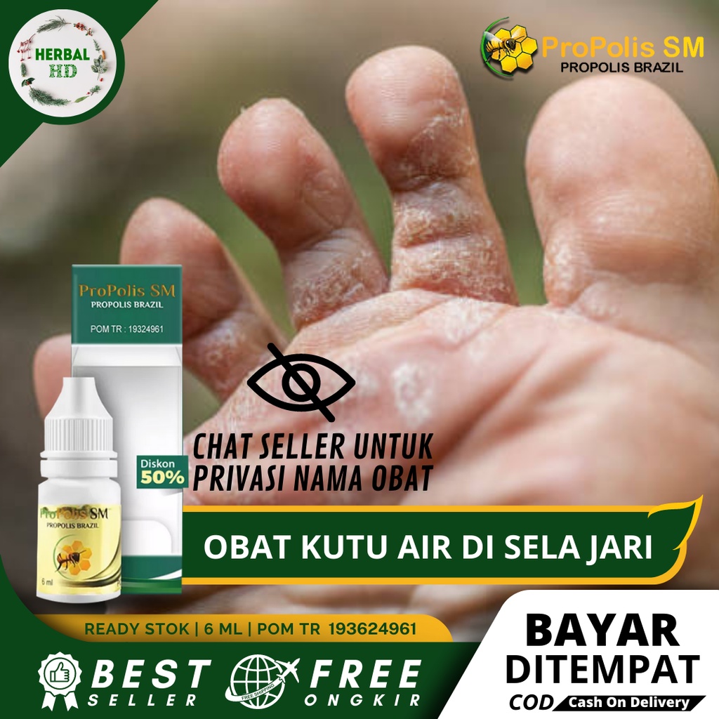 Obat Kutu Air, Obat Kutu Air Di Kaki, Obat Kutu Air Gatal Di Sela Jari, Obat Kutu Air Untuk Kaki, Ob