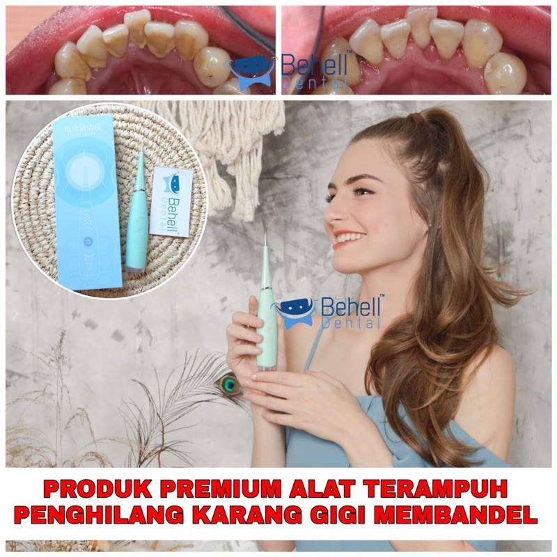 ALAT PENGHILANG KARANG GIGI TERAMPUH  . Dental Pembersih plak gigi SCALER SCALLER PORTABLE elektrik . PERONTOK PEMUTIH LEM BEHEL DENTAL