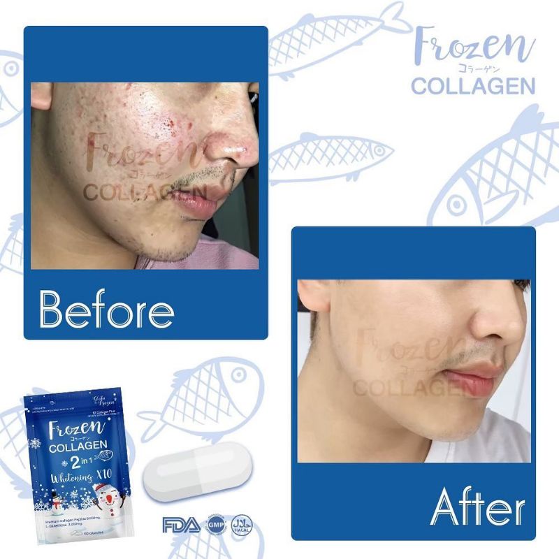 FROZEN COLLAGEN ORIGINAL THAILAND HALAL BARCODE - PEMUTIH KULIT GLUTA WHITENING COLAGEN 60 KAPSUL