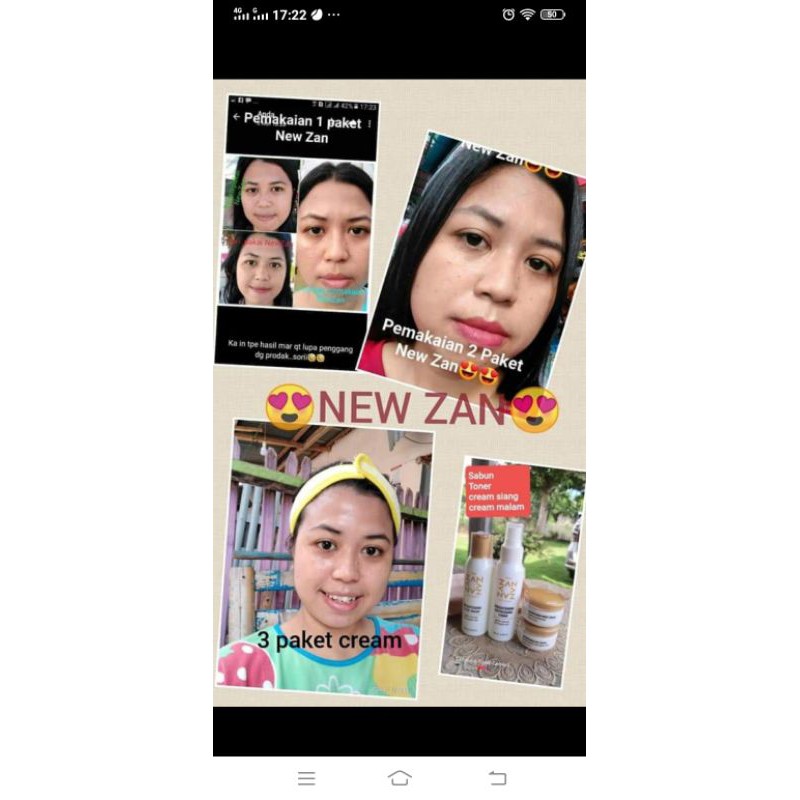 (BISA COD) SKINCARE NEW ZAN SKINEXPERT