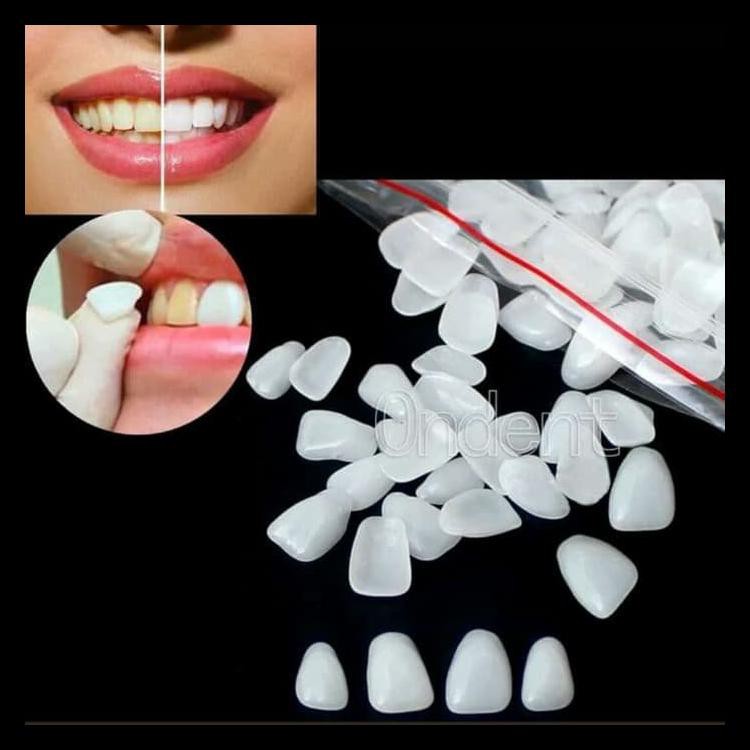 Crown Gigi Veneer Super White Atas Bawah 50 Pcs