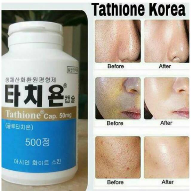 Tathione korea