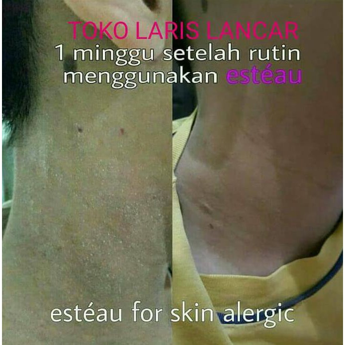 HYDROGEN FONTAINE & ESTEAU - BEST SELLER - ASLI BERGARANSI