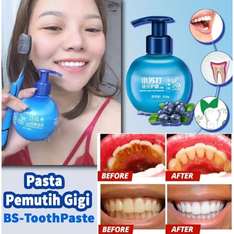 BS TOOTHPASTE PEMUTIH GIGI BAKING SODA PENGHILANG PLAK GIGI BS TOOTHPASTE ORIGINAL PEMBERSIH GIGI PASTA PENCERAH GIGI-220gr