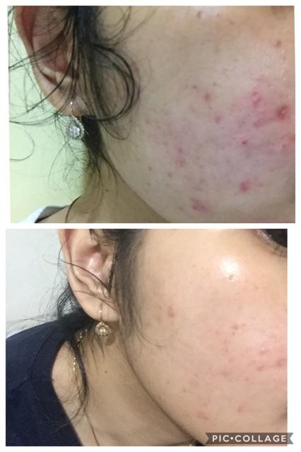 Facial Wash Bogotaskincare