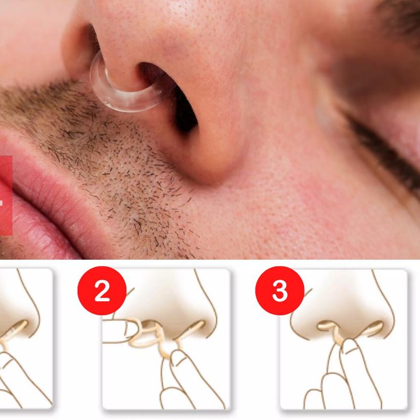 ♠ Alat Anti Ngorok Dengkur Saat Tidur Snore Stoper Intra Nasal Breathe Aid ♂