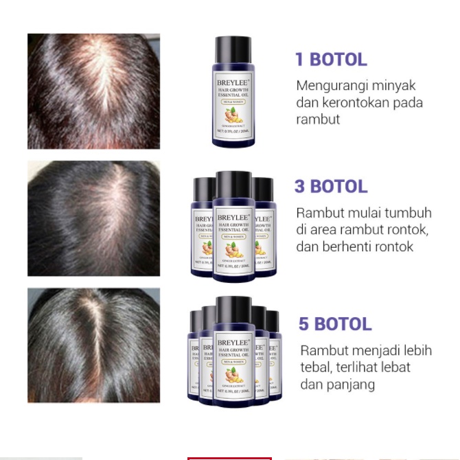 [BPOM] Breylee Hair Essential Oil - BREYLEE Serum Penumbuh Rambut Menyehatkan Kulit Kepala &amp; Meningkatkan Regenerasi Rambut 20ML