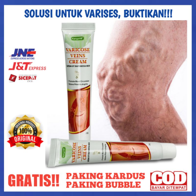 CREAM KAKI VARISES OBAT VARISES