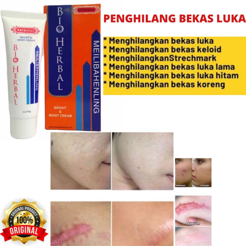 MEILIBAHENLING BIOHERBAL ORIGINAL ASLI BPOM HALAL, CREAM PENGHILANG BEKAS LUKA, KELOID, STRECH MARK, FLEK HITAM, BEKAS CACAR, BEKAS JERAWAT, KORENG DAN BOPENG