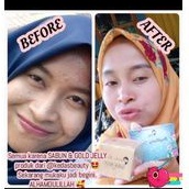 sabun kedas beauty, Pemutih Wajah, Badan ,Flek ,Ketiak ,Pria, Original-8