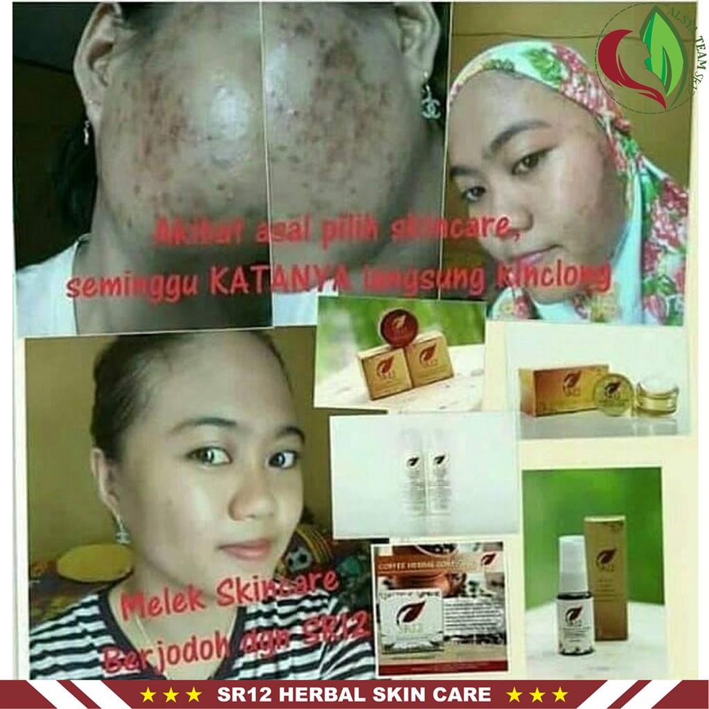 Spot Essence SR12 | Spot Essence Day Cream &amp; Spot Essence Night Cream | Krim Wajah SR12 Skincare