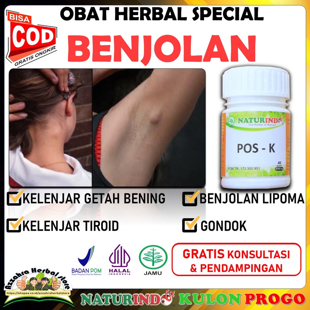 Jual Obat benjolan kelenjar getah bening kelenjar tiroid lipoma di