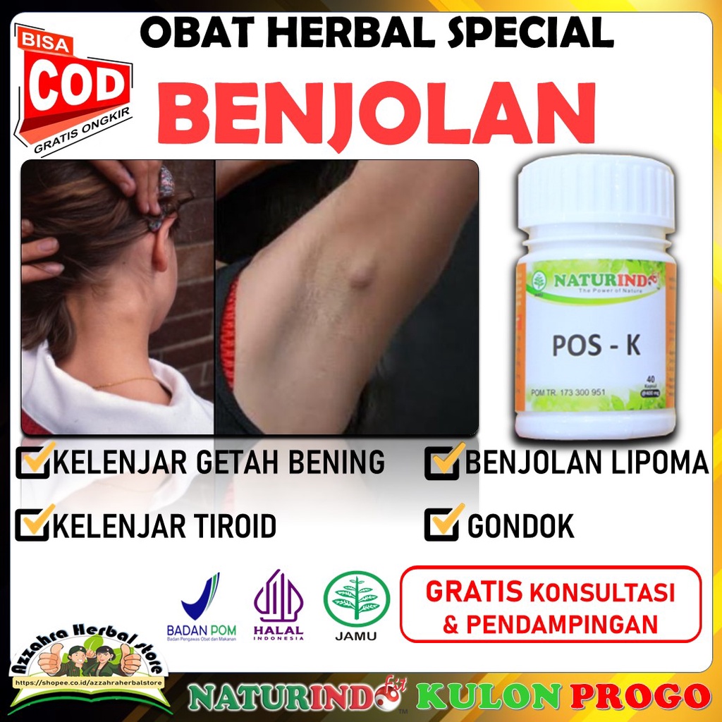 Jual Obat Benjolan Kelenjar Getah Bening Kelenjar Tiroid Lipoma Di