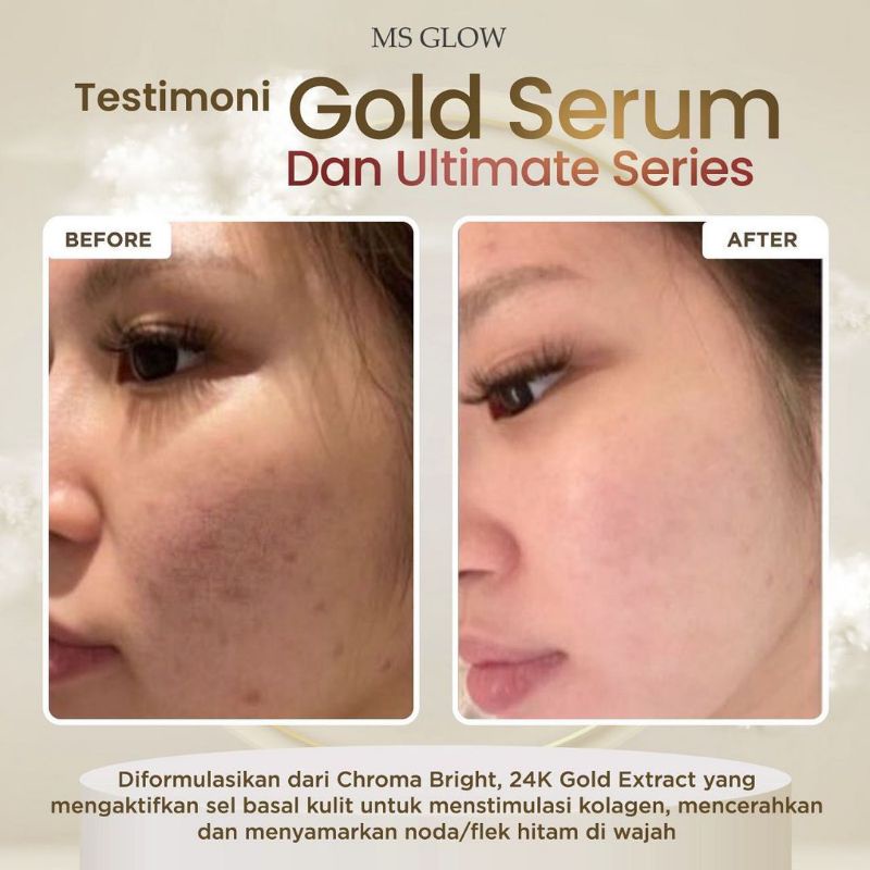 Serum Gold Whitening MS GLOW.