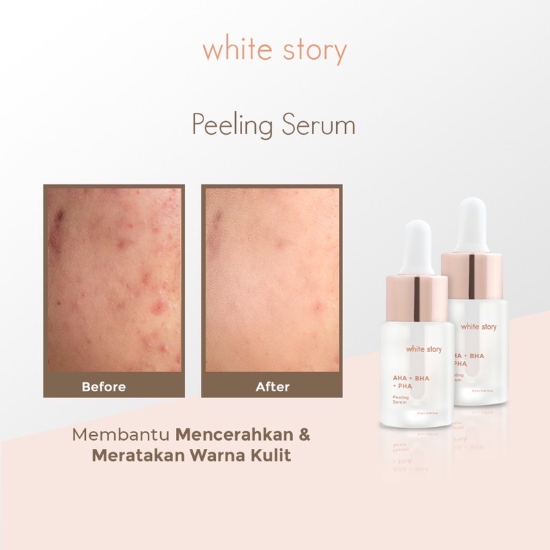 WHITE STORY Peeling Serum Indonesia / Brightening Acne Hydrating Advanced Soothing Exfoliating / Facial Wash Toner Essence Day Night Underarm Eye Cream Gel Clay Mask Masker Wajah Cleanser Cleansing Moisturizer Body Scrub Soap Face Care Oil / Paket Lengkap