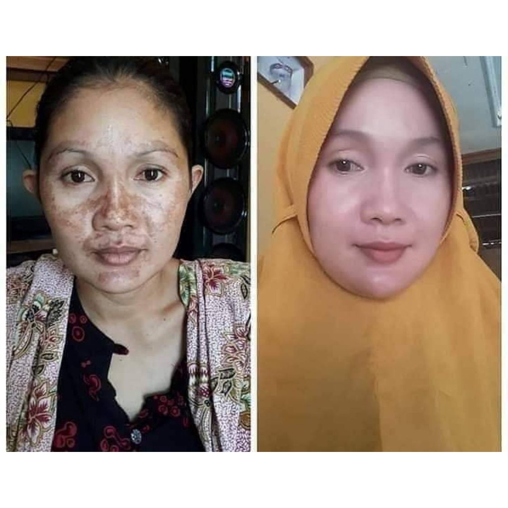 MASKER WAJAH HANASUI NATURGO MASKER GOLD HANASUI BPOM - MASKER NATURGO GOLD ANTI AGING