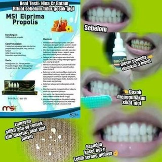 Obat Perontok Karang Gigi Pembersih Gigi Kuning Propolis Obat Perontok Karang Gigi Pembersih Gigi Kuning Propolis