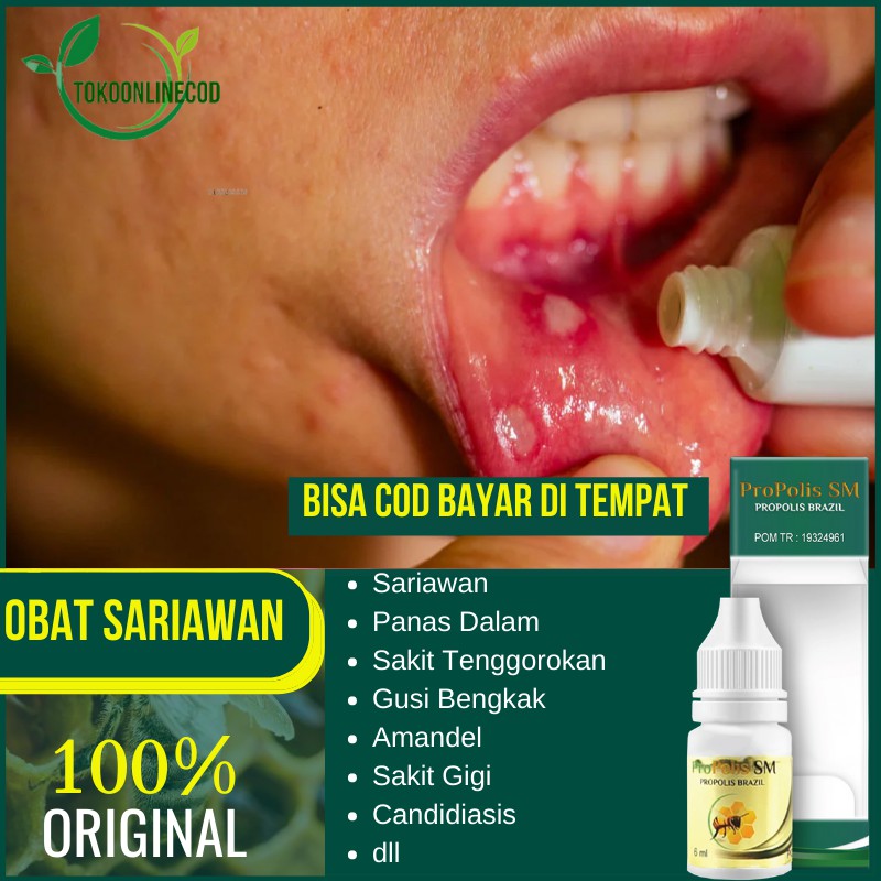 Obat Sariawan Anak - Sariawan Mulut - Panas Dalam - Radang Tenggorokan - Amandel Anak Dewasa Bpom