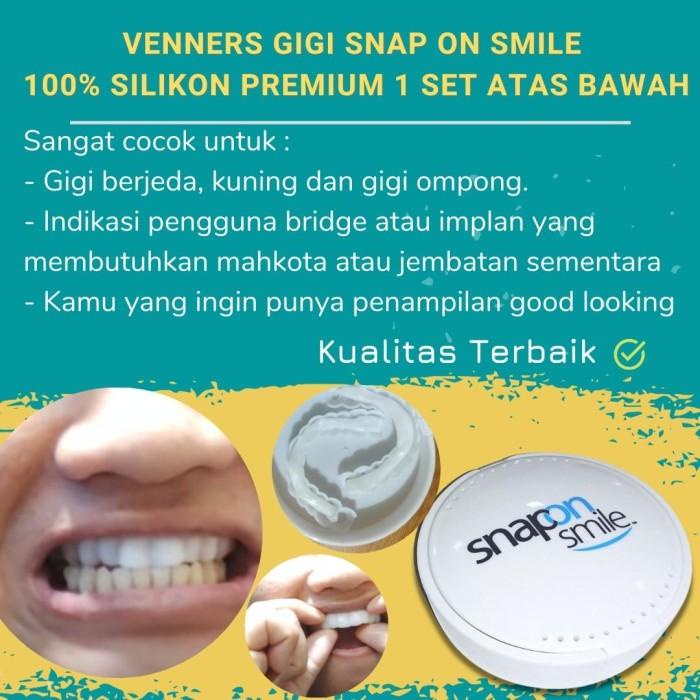Vier | Veneer Snap On Smile Gigi Palsu Silikon Berkualitas 1 Set Pelapis Gigi
